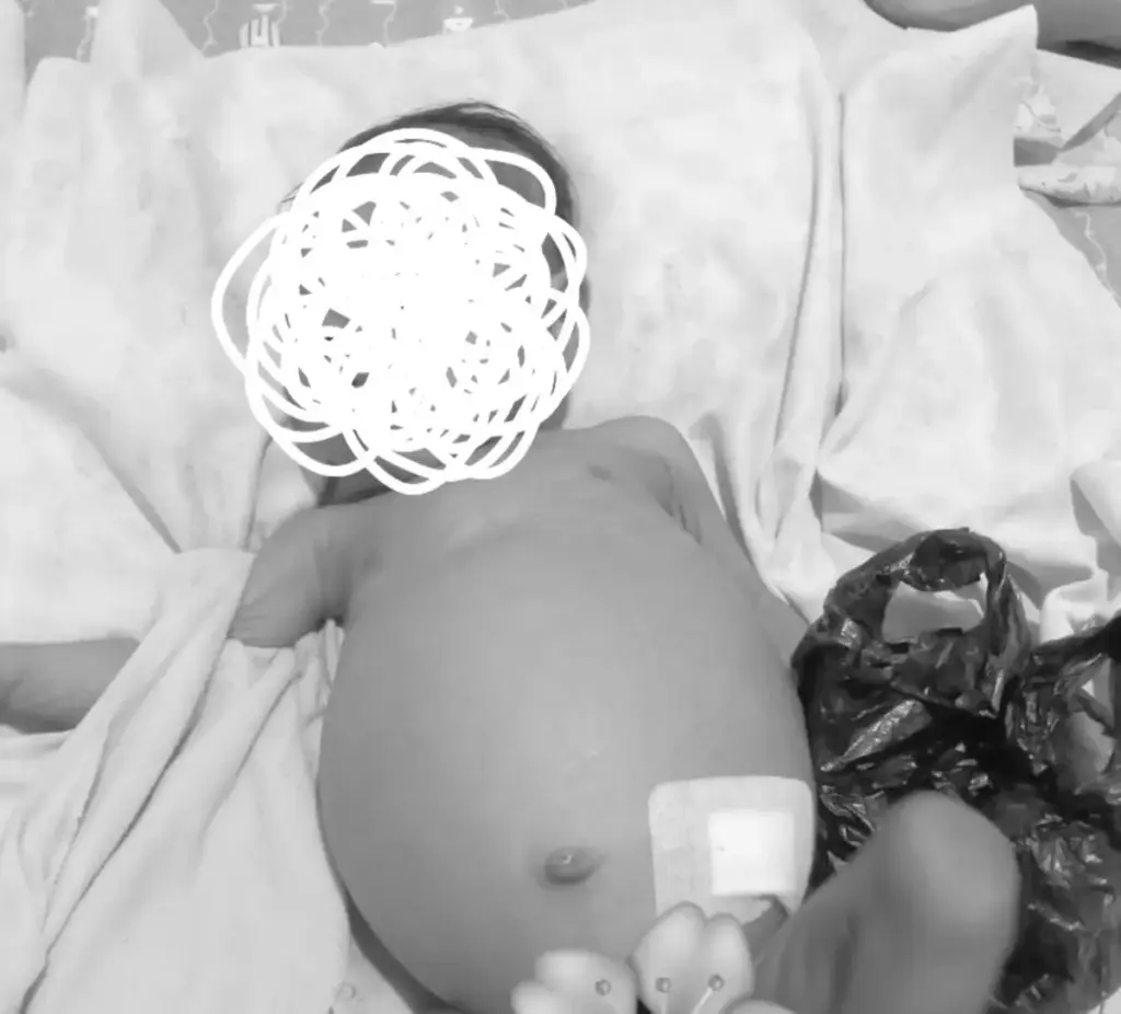 Bayi 8 Bulan Asal Cigombong Alami Penyakit Langka, Orang Tua Butuh Biaya