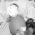 Bayi 8 Bulan Asal Cigombong Alami Penyakit Langka, Orang Tua Butuh Biaya